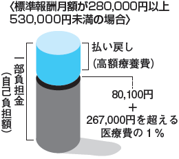 一部負担金